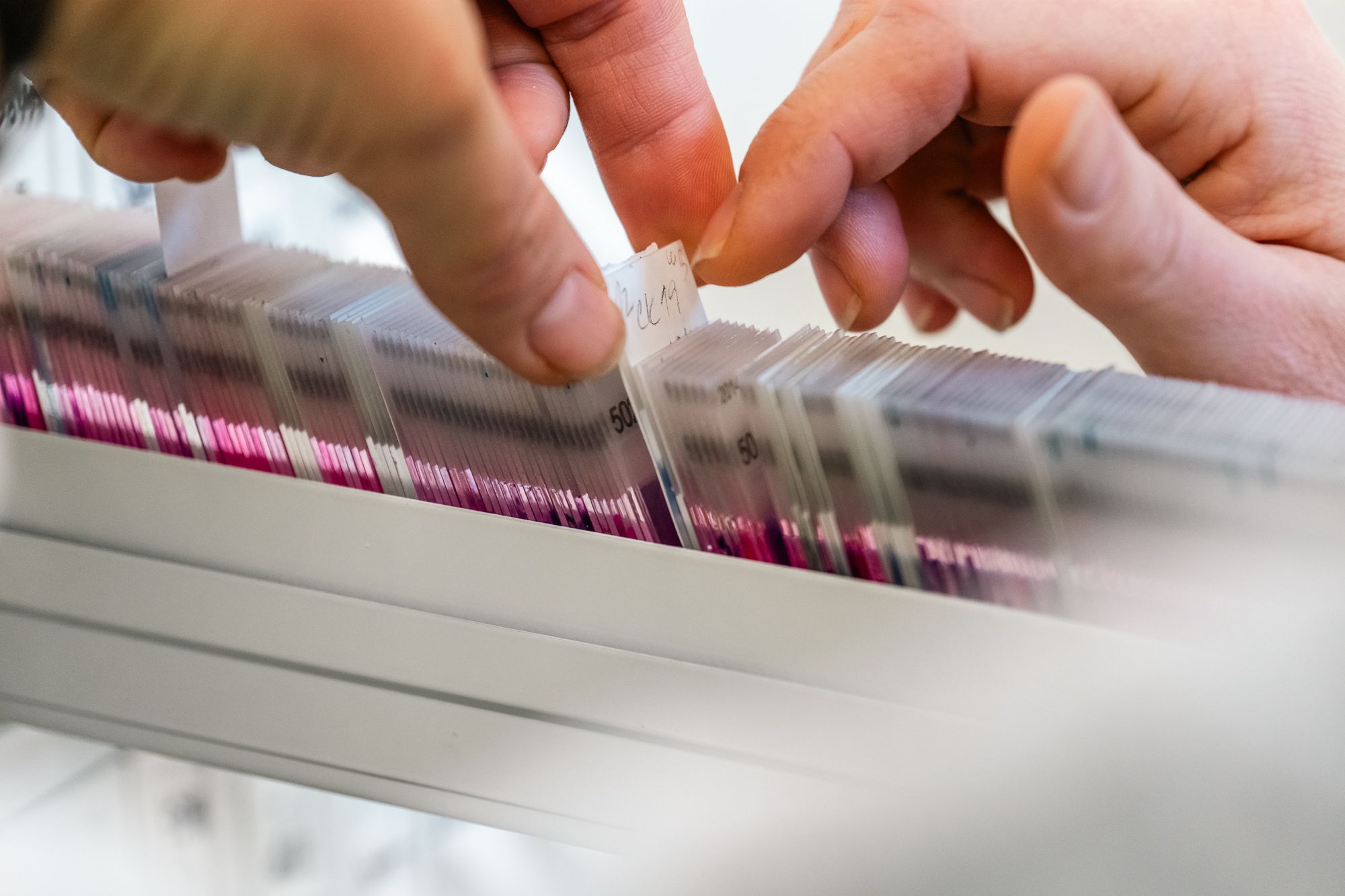 Síť českých biobank BBMRI.cz je partnerem Aliance žen s rakovinou prsu.